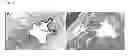 Fig. 04 - PREVENTION OF RECURRENCES OF URETHRAL STRICTURES FOLLOWING CONVENTIONAL THERAPY