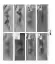 Fig. 07 - USE OF CYSTEAMINE IN TREATING PARKINSON'S DISEASE