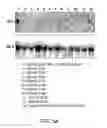 Fig. 06 - ANTISENSE DESIGN