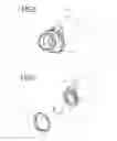 Fig. 02 - Flexible applicator for radiation therapy