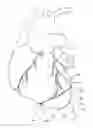 Fig. 01 - Ventricular assist device sleeve adapter