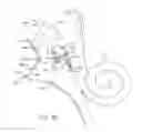 Fig. 06 - Optically Coupled Bone Conduction Systems and Methods