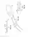 Fig. 04 - Methods and implants for treating urinary incontinence