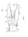 Fig. 04 - JAWED TROCAR TIP ASSEMBLY