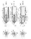 Fig. 08 - JAWED TROCAR TIP ASSEMBLY