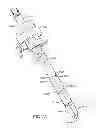 Fig. 22 - JAWED TROCAR TIP ASSEMBLY