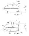 Fig. 32 - JAWED TROCAR TIP ASSEMBLY