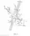 Fig. 09 - Surgical access system and related methods