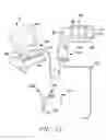 Fig. 13 - Surgical access system and related methods