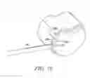 Fig. 19 - Surgical access system and related methods