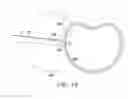 Fig. 20 - Surgical access system and related methods