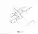 Fig. 22 - Surgical access system and related methods
