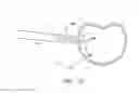Fig. 24 - Surgical access system and related methods