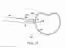 Fig. 26 - Surgical access system and related methods