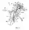 Fig. 02 - Surgical access system and related methods