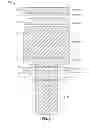 Fig. 05 - SEM scanner sensing apparatus, system and methodology for early detection of ulcers