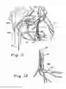 Fig. 09 - Devices, systems and methods for acute or chronic delivery of substances or apparatus to extravascular treatment sites