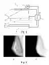 Fig. 02 - Method and device for imaging soft body tissue using X-ray projection and optical tomography