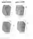 Fig. 07 - System and device for tumor characterization using nonlinear elastography imaging