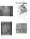 Fig. 08 - System and device for tumor characterization using nonlinear elastography imaging