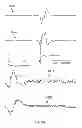 Fig. 27 - Multi-channel cardiac measurements