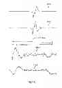 Fig. 31 - Multi-channel cardiac measurements