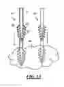 Fig. 09 - Insertable neural probe with flexible structure