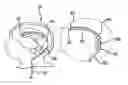 Fig. 01 - VENTRICULAR SHUNT SYSTEM AND METHOD