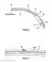 Fig. 06 - VENTRICULAR SHUNT SYSTEM AND METHOD