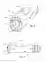 Fig. 04 - METHOD AND APPARATUS FOR HYSTEROSCOPY AND ENDOMETRIAL BIOPSY
