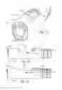 Fig. 08 - METHOD AND APPARATUS FOR HYSTEROSCOPY AND ENDOMETRIAL BIOPSY