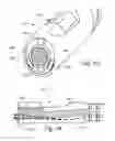 Fig. 09 - METHOD AND APPARATUS FOR HYSTEROSCOPY AND ENDOMETRIAL BIOPSY