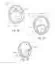 Fig. 15 - METHOD AND APPARATUS FOR HYSTEROSCOPY AND ENDOMETRIAL BIOPSY