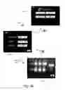 Fig. 28 - METHOD AND APPARATUS FOR HYSTEROSCOPY AND ENDOMETRIAL BIOPSY