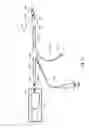 Fig. 34 - METHOD AND APPARATUS FOR HYSTEROSCOPY AND ENDOMETRIAL BIOPSY