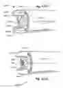 Fig. 71 - METHOD AND APPARATUS FOR HYSTEROSCOPY AND ENDOMETRIAL BIOPSY