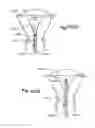 Fig. 72 - METHOD AND APPARATUS FOR HYSTEROSCOPY AND ENDOMETRIAL BIOPSY