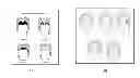 Fig. 01 - Method and apparatus for determining anatomic properties of a patient