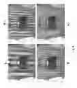 Fig. 05 - Method and apparatus for determining anatomic properties of a patient