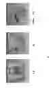 Fig. 06 - Method and apparatus for determining anatomic properties of a patient