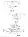 Fig. 28 - Analgesic implant device and system