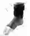 Fig. 01 - ANKLE-FOOT ORTHOSES