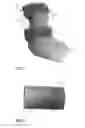 Fig. 02 - ANKLE-FOOT ORTHOSES