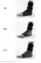 Fig. 06 - ANKLE-FOOT ORTHOSES