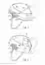 Fig. 02 - CRANIAL CAP