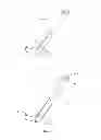 Fig. 02 - Transvaginal specimen extraction device