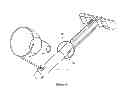 Fig. 04 - Transvaginal specimen extraction device