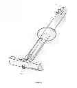 Fig. 05 - Transvaginal specimen extraction device