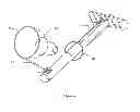 Fig. 07 - Transvaginal specimen extraction device
