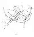 Fig. 09 - Transvaginal specimen extraction device